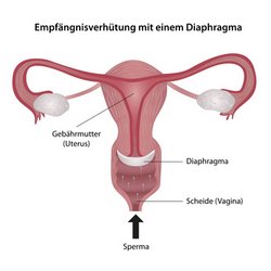 Funktion des Diaphragmas. (&copy; bilderzwerg - Fotolia.com)